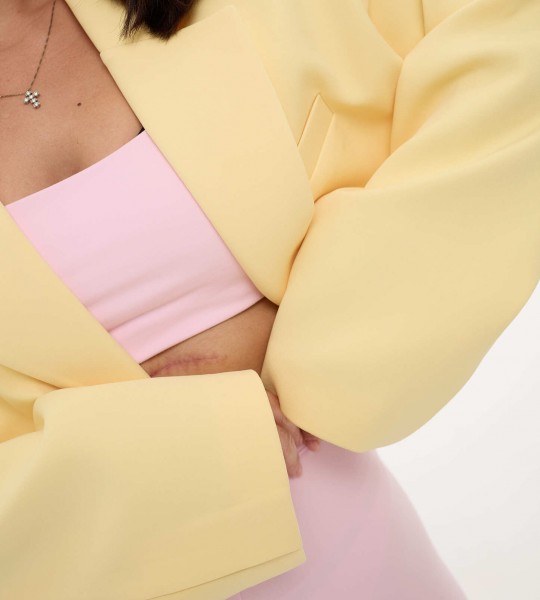 Блейзер Crop Edge Жовтий | Showroom By Nona — зображення 4